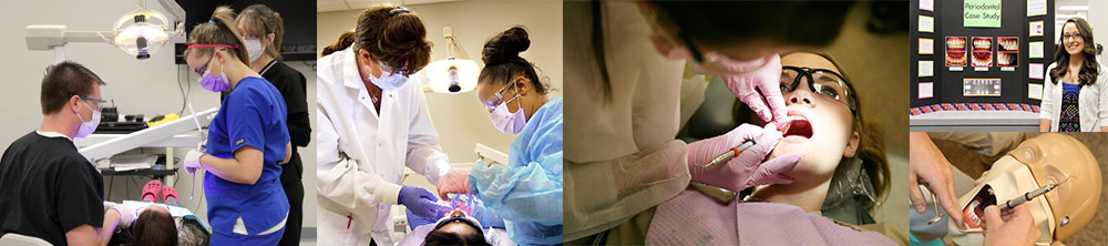 a collage of people having their teeth cleaned by dental hygienist.